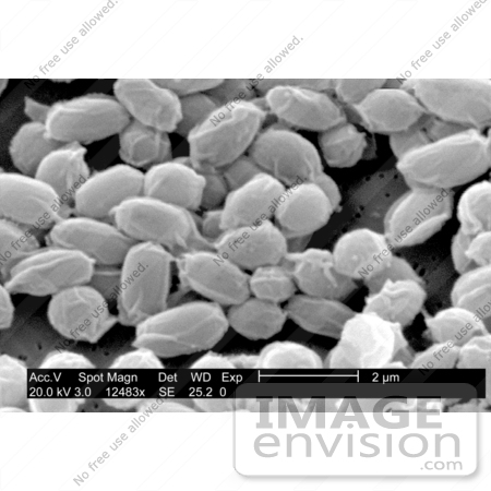 #5052 Stock Photography of Spores from Bacillus Anthracis Bacteria by JVPD