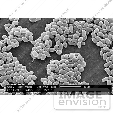 #5053 Micrograph Stock Photography of Anthrax Spores by JVPD