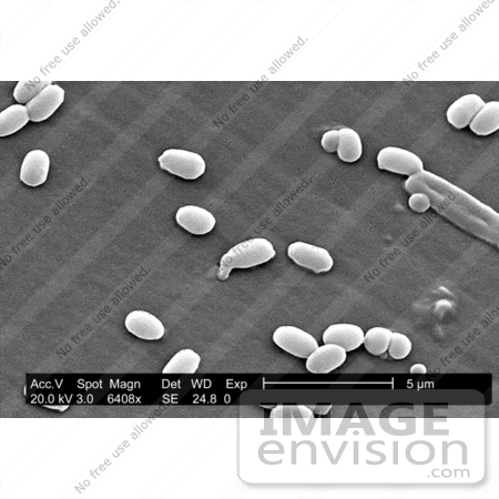 #5054 Stock Photography of a Strain of Bacillus Anthracis Bacteria by JVPD