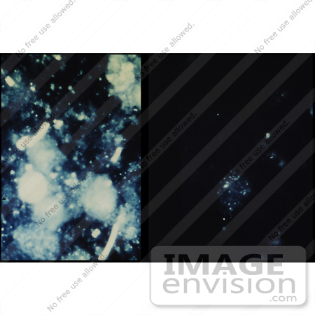 #5055 Stock Photography of an Anthrax Positive Lymph Node Impression Smear by JVPD