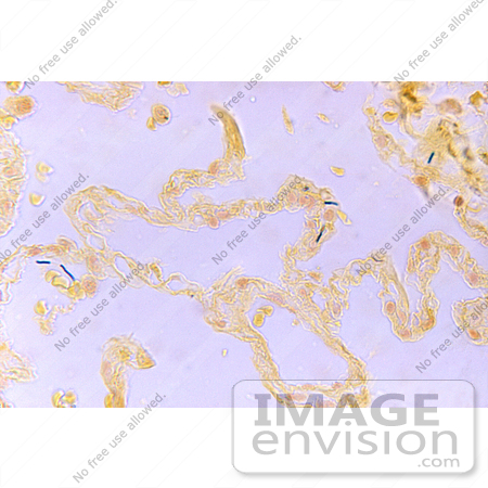 #5056 Stock Photography of Bacillus Anthracis in a Lung by JVPD