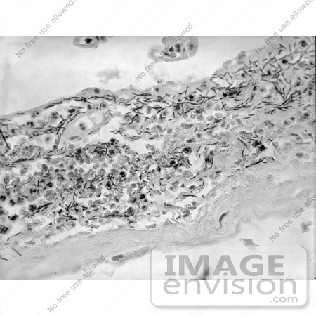 #5058 Stock Photography of Bacillus Anthracis (Anthrax) in Meninges by JVPD
