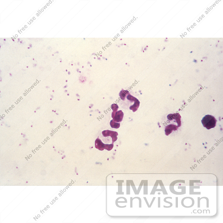 #5130 Micrograph Picture of Plasmodium Falciparum Parasites in the Form of Numerous Rings by JVPD