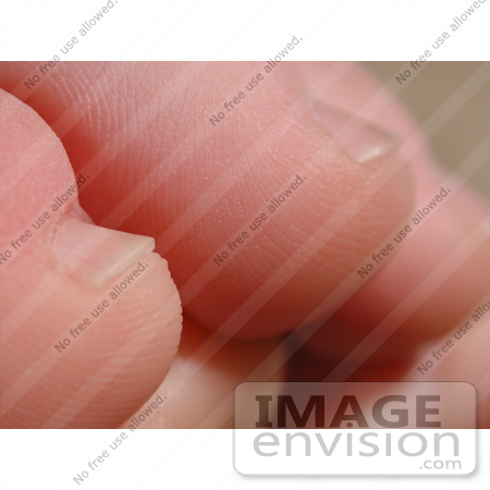 #71 Picture of Human Toes by Kenny Adams