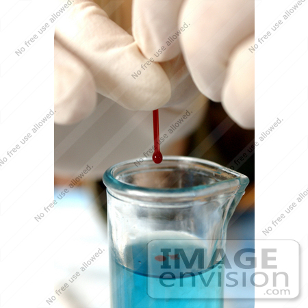 #8933 Picture of Testing Blood for Iron Levels by JVPD