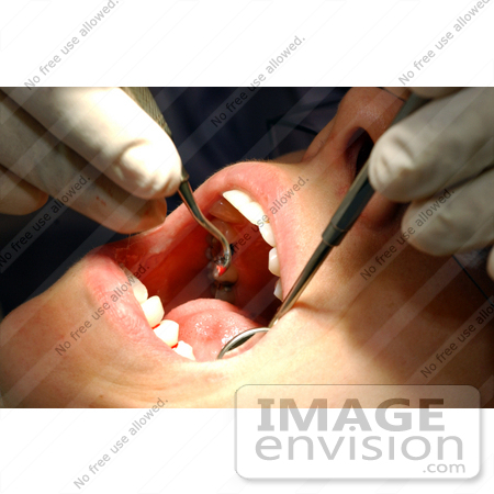 #8989 Picture of a Dental Exam by JVPD