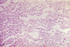 #5023 Photomicrograph of Lung Tissue Infected with Bacillus Anthracis Bacteria by JVPD