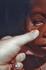#6768 Picture of a CDC EIS Officer Examining the Palpebral Conjunctiva of a Nigerian Child with Anemia Symptoms by KAPD