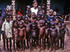 #7478 Picture of a Nurse Standing with a Group of African Children Showing Symptoms of the Protein-Deficiency Disease Kwashiorkor by KAPD