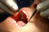 #8989 Picture of a Dental Exam by JVPD