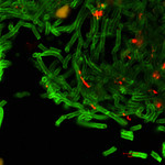 Free Picture of Green Anthrax Cell Walls and Red Anthrax Spores.