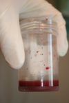 Blood in a Container