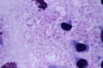 Mediastinal Lymph Node from a Cynomolgus Monkey Infected with Anthrax.