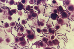 Anthrax Micrograph