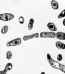 Bacillus anthracis (Anthrax)