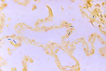 Bacillus Anthracis in a Lung