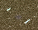 Bacillus Anthracis Indian Ink Capsule Stain