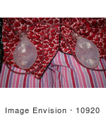 #10920 Stock Photo of Breast Reduction Patient’s Drainage Tubes by Kenny Adams