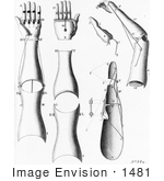 #1481 Photo Of Prosthetic Arms And Hands