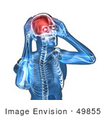 #49855 Royalty-Free (Rf) Illustration Of A 3d Transparent Blue Human Body With A Migraine - Version 5