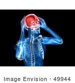 #49944 Royalty-Free (Rf) Illustration Of A 3d Clear Human Being Character With A Migraine - Version 1