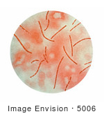 #5006 Stock Photography Of Anthrax Bacteria Taken From Heart Blood