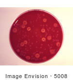 #5008 Stock Photography Of A Blood Agar Culture Plate Growing Bacillus Anthracis (Anthrax)