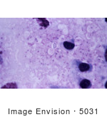 #5031 Stock Photography Of Mediastinal Lymph Node From A Cynomolgus Monkey Infected With Anthrax