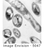 #5047 Anthrax Micrograph