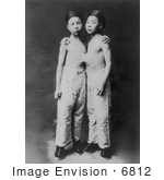 #6812 Korean Siamese Twins