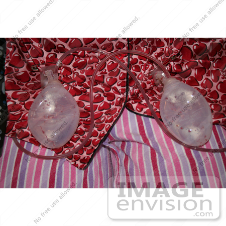 #10920 Stock Photo of Breast Reduction Patient’s Drainage Tubes by Kenny Adams