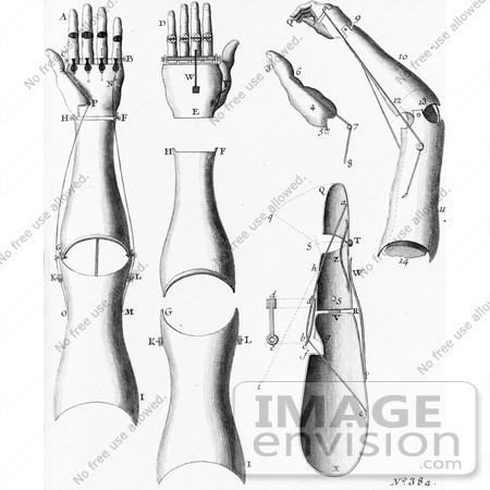 #1481 Photo of Prosthetic Arms and Hands by JVPD