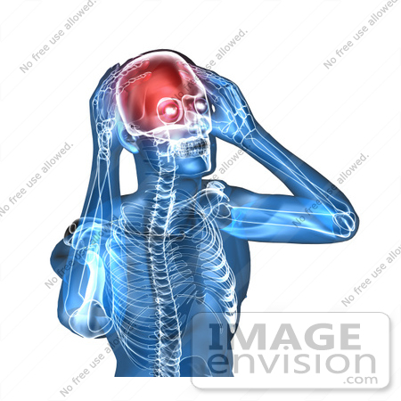 #49855 Royalty-Free (RF) Illustration Of A 3d Transparent Blue Human Body With A Migraine - Version 5 by Julos