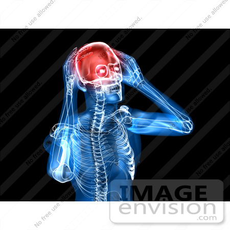 #49944 Royalty-Free (RF) Illustration Of A 3d Clear Human Being Character With A Migraine - Version 1 by Julos