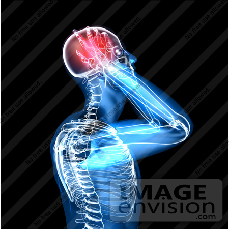 #49945 Royalty-Free (RF) Illustration Of A 3d Clear Human Being Character With A Migraine - Version 2 by Julos