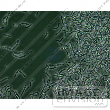 #5035 Stock Photography of Anthrax Spores by JVPD