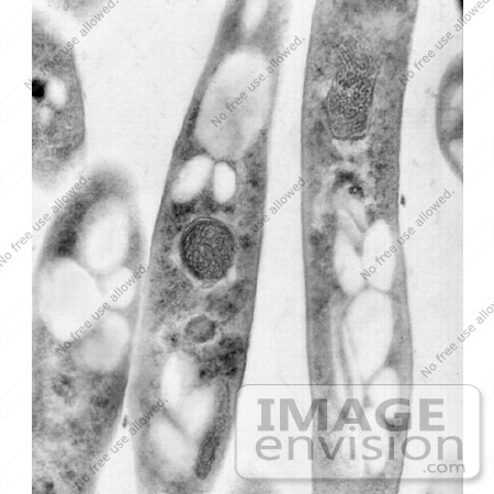 #5046 Bacillus anthracis Transmission Electron Micrograph by JVPD