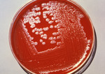Agar Culture Plate Growing Anthrax Colonies