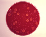 Blood Agar Culture Plate Growing Bacillus Anthracis (Anthrax)