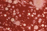 Anthrax Growing On an Agar Culture Plate with Blood