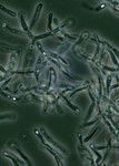 Bacillus Anthracis Spores Seen Under Phase Contrast Microscopy