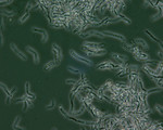 Bacillus Anthracis Spores