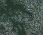 Bacillus Anthracis Spores