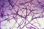Anthrax Bacteria Displayed During a Gram Stain Technique