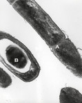 Anthrax Transmission Electron Micrograph