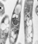 Bacillus anthracis Transmission Electron Micrograph