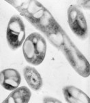 Anthrax Micrograph