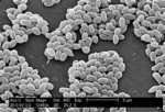 Anthrax (Bacillus anthracis) Spores Micrograph