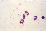 Micrograph of Plasmodium Falciparum Parasites in the Form of Numerous Rings