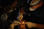 Performing a Tooth Extraction